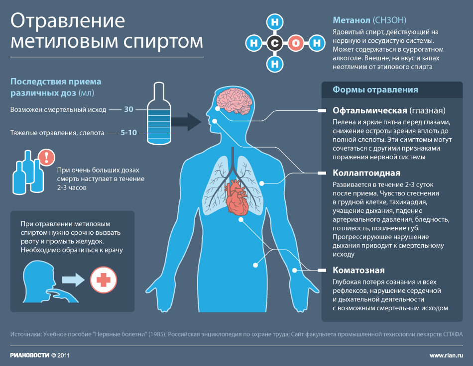 Отравление метиловым спиртом