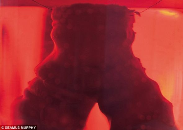 生物反应器中培养的人造气管。科学家近期成功实施了世界首例人造器官移植,将这个气管移植到患者体内。 生物反应器中培养的人造气管。科学家近期成功实施了世界首例人造器官移植,将这个气管移植到患者体内。