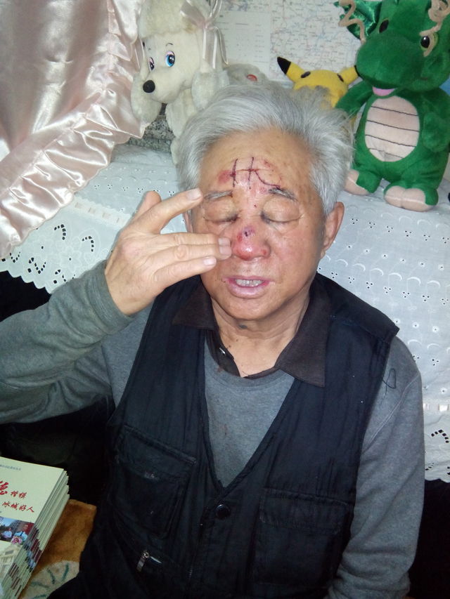 七旬翁摔破头众路人上前救助冰城人不怕被讹
