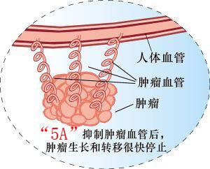 血管生成抑制与肿瘤双月刊09年第6期-印刷版-学路网-学习路上 有我相