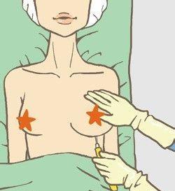 咪咪乐丰胸提示:5个坏习惯 随时毁掉性感-丰胸