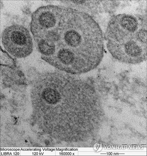 세포내에 발견된 메르스 바이러스(연합뉴스,자료사진)