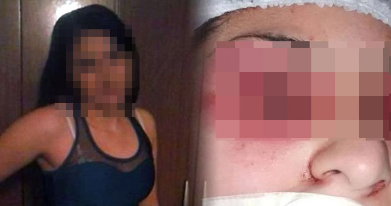 16岁少女被指鬼上身遭轮奸姐姐亲手挖眼驱魔图